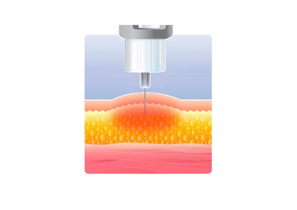 сахар-3.jpg сахар-3.jpg